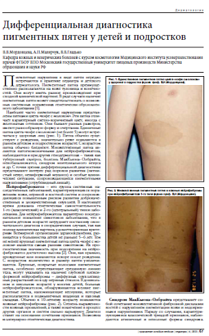 Дифференциальная диагностика пигментных пятен у детей и подростков
