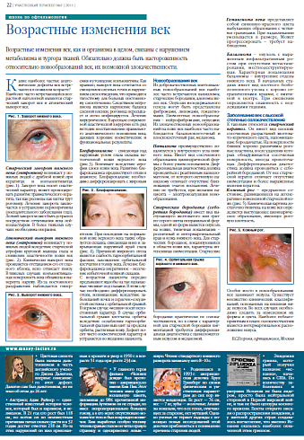 Возрастные изменения век