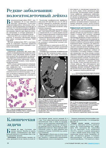 Редкие заболевания:  волосатоклеточный лейкоз