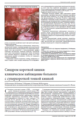 Синдром короткой кишки:  клиническое наблюдение больного  с суперкороткой тонкой кишкой