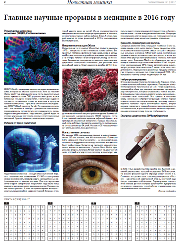 Нейропротезирование