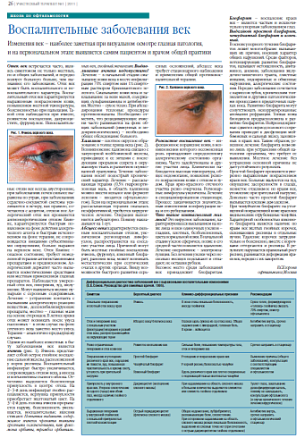  Воспалительные заболевания век