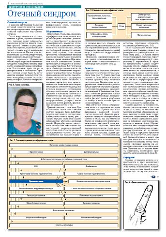 Отeчный синдром