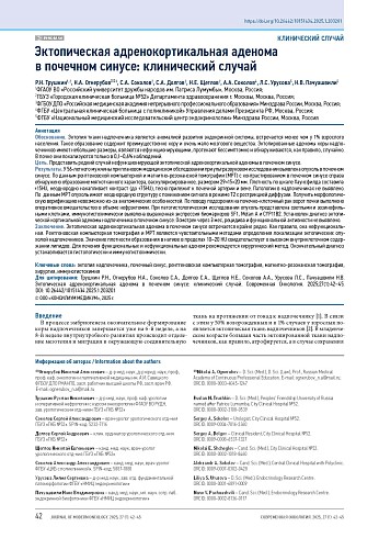 Эктопическая адренокортикальная аденома в почечном синусе: клинический случай