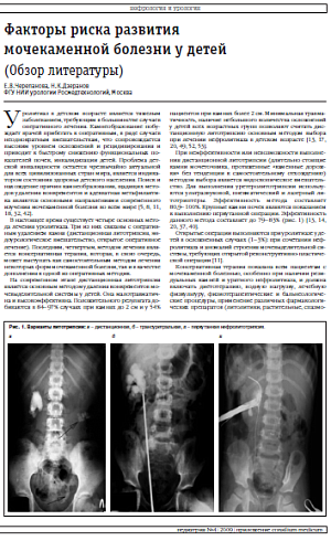 Факторы риска развития мочекаменной болезни у детей (Обзор литературы)