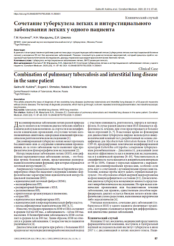 Сочетание туберкулеза легких и интерстициального заболевания легких у одного пациента