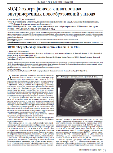 3D/4D-эхографическая диагностика внутричерепных новообразований у плода  С.М.Воеводин1, Т.В.Шеманаева2