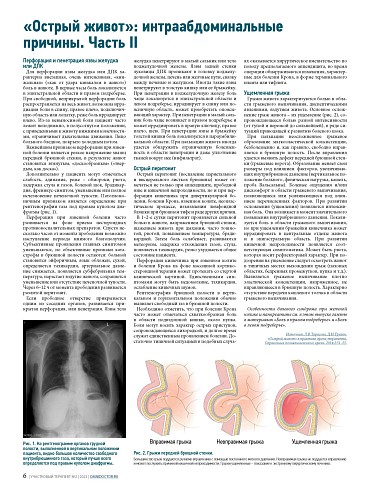 «Острый живот»: интраабдоминальные причины. Часть II
