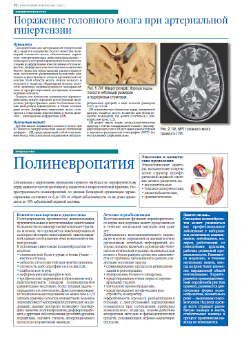 Поражение головного мозга при артериальной гипертензии