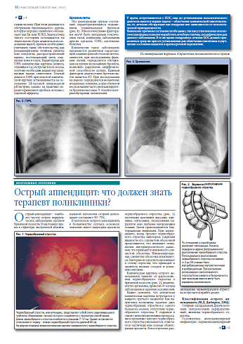 Острый аппендицит: что должен знать терапевт поликлиники?