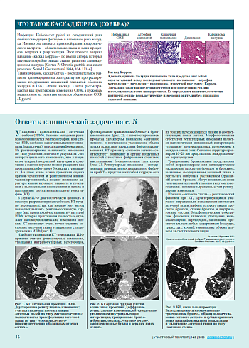 Что такое каскад Корреа (Correa)?