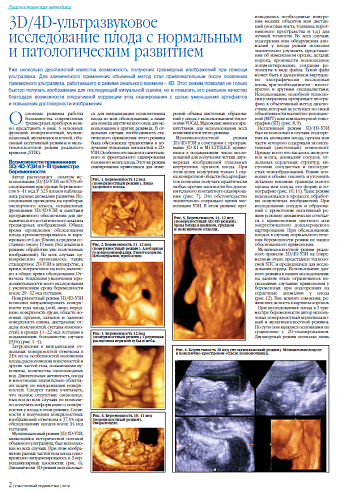 3D/4D-ультразвуковое исследование плода с нормальным и патологическим развитием