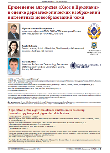 Применение алгоритма «Хаос и Признаки» в оценке дерматоскопических изображений пигментных новообразований кожи