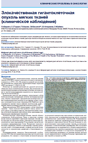 Злокачественная гигантоклеточная опухоль мягких тканей  (клиническое наблюдение)