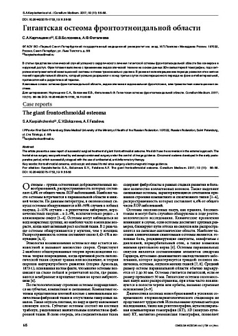 Гигантская остеома фронтоэтмоидальной области