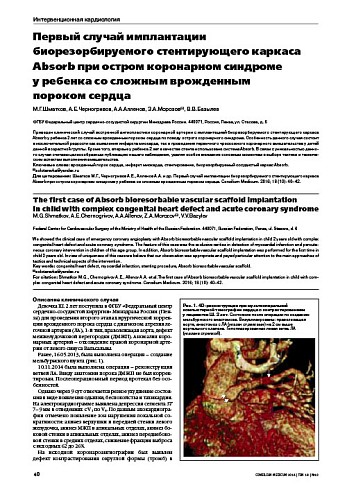 Первый случай имплантации биорезорбируемого стентирующего каркаса Absorb при остром коронарном синдроме  у ребенка со сложным врожденным  пороком сердца