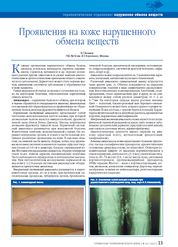 Проявления на коже нарушенного обмена веществ