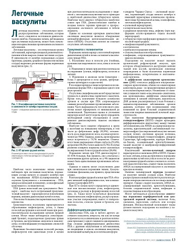 Легочные васкулиты