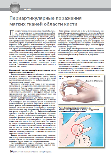 Периартикулярные поражения мягких тканей области кисти