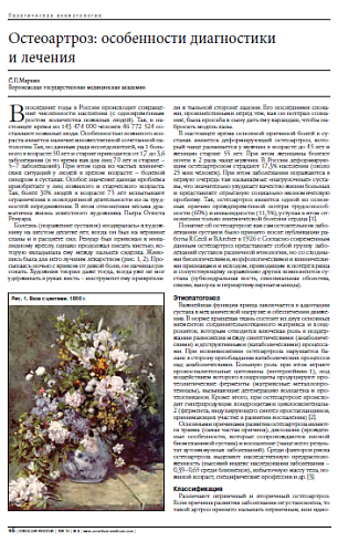 Остеоартроз: особенности диагностики  и лечения