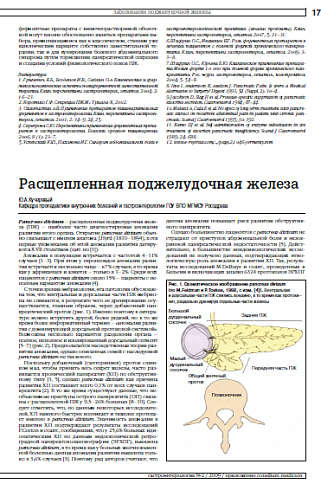 Расщепленная поджелудочная железа