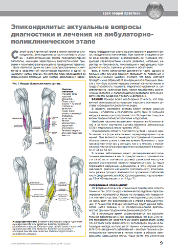 Эпикондилиты: актуальные вопросы диагностики и лечения на амбулаторно-поликлиническом этапе