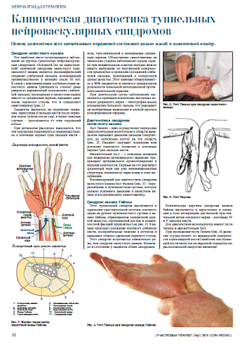 Клиническая диагностика туннельных нейроваскулярных синдромов