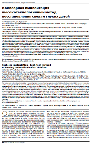 Кохлеарная имплантация – высокотехнологичный метод  восстановления слуха у глухих детей