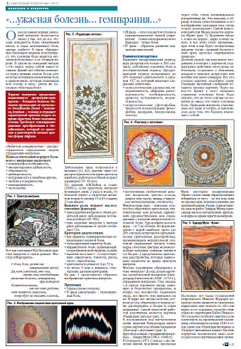   «...ужасная болезнь... гемикрания...»