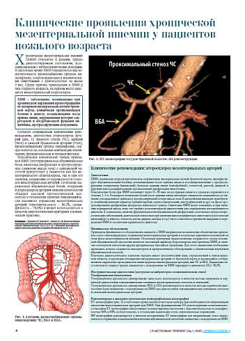 Клинические проявления хронической мезентериальной ишемии у пациентов пожилого возраста