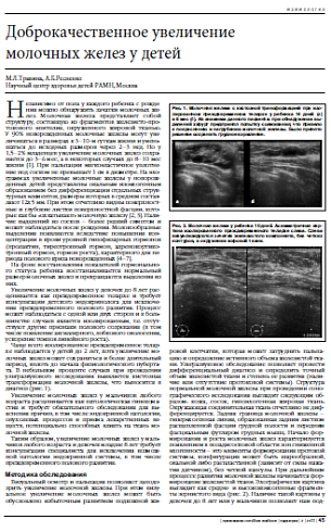 Доброкачественное увеличение  молочных желез у детей
