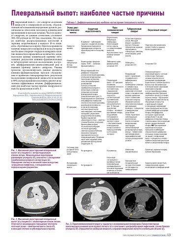 Плевральный выпот: наиболее частые причины