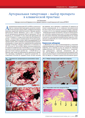 Артериальная гипертония – выбор препарата в клинической практике