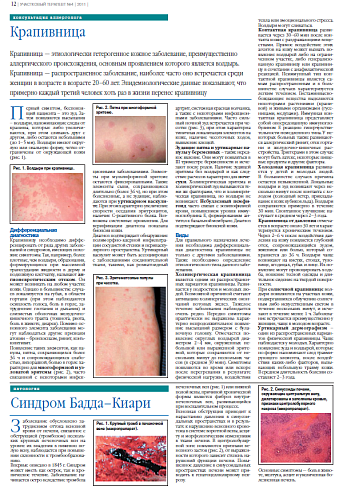 Крапивница 