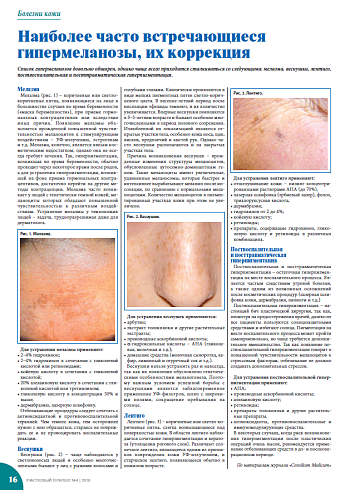 Наиболее часто встречающиеся гипермеланозы, их коррекция