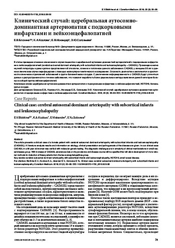 Клинический случай: церебральная аутосомно-доминантная артериопатия с подкорковыми инфарктами и лейкоэнцефалопатией