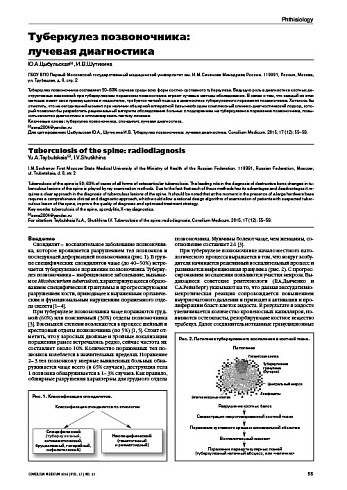 Туберкулез позвоночника:  лучевая диагностика