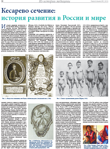 Кесарево сечение:  история развития в России и мире