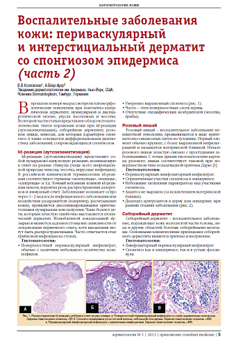 Воспалительные заболевания кожи: периваскулярный  и интерстициальный дерматит  со спонгиозом эпидермиса (часть 2)