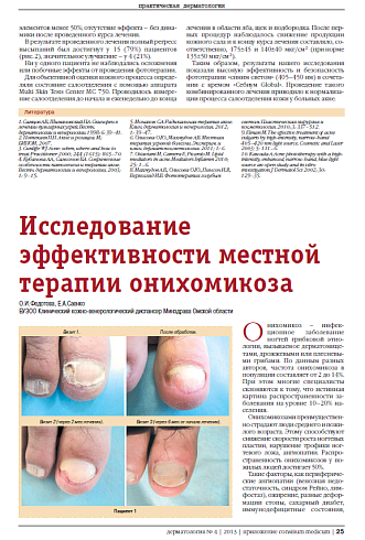 Исследование эффективности местной терапии онихомикоза