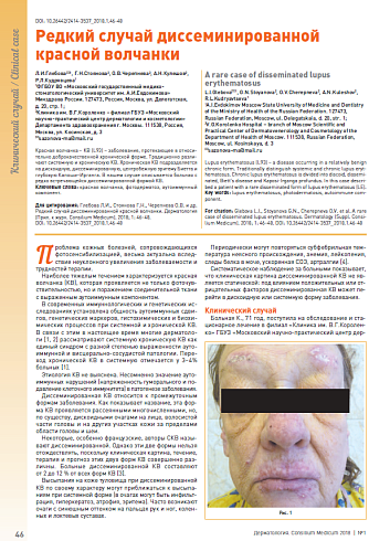 Редкий случай диссеминированной красной волчанки