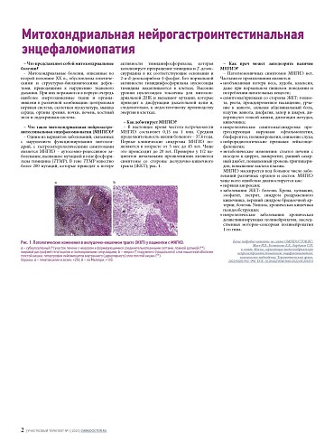 Митохондриальная нейрогастроинтестинальная энцефаломиопатия