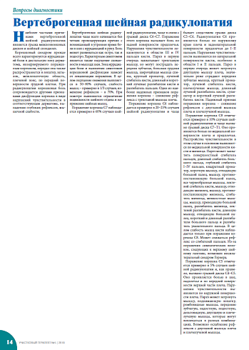 Вертеброгенная шейная радикулопатия