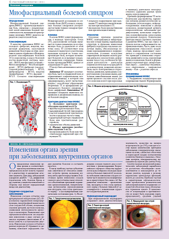 Миофасциальный болевой синдром
