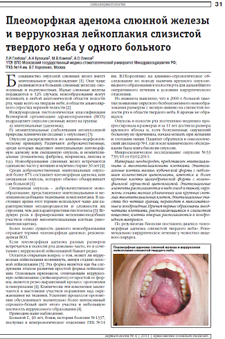 Плеоморфная аденома слюнной железы и веррукозная лейкоплакия слизистой твердого неба у одного больного