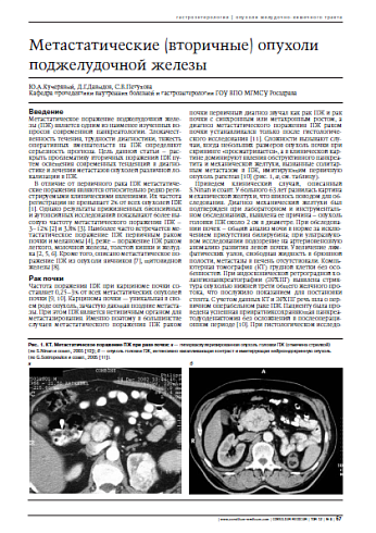 Метастатические (вторичные) опухолиподжелудочной железы