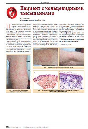 Пациент с кольцевидными высыпаниями