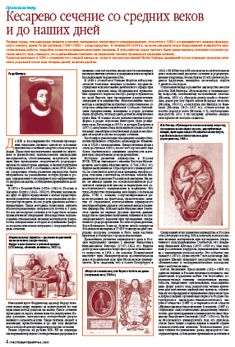 Кесарево сечение со средних веков и до наших дней