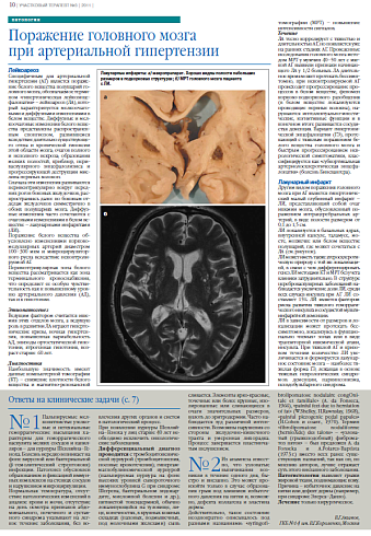   Поражение головного мозга  при артериальной гипертензии
