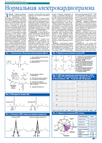 Нормальная электрокардиограмма